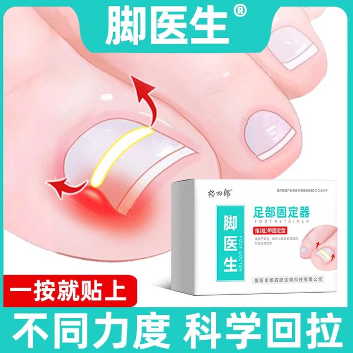 脚医生甲沟嵌甲矫正器正甲贴脚趾甲贴片指甲长肉里足部固定器