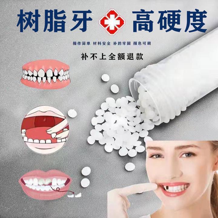 【现货秒发自己diy】神器牙齿填充剂  牙缝堵牙洞临时粘牙胶
