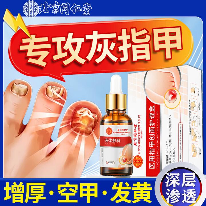 北京同仁堂灰指甲专用药正品细菌真菌指甲感染甲沟炎灰指甲指甲变白甲增厚甲萎缩凹凸不平甲分层甲癣医用指甲创面护理盒内廷上用