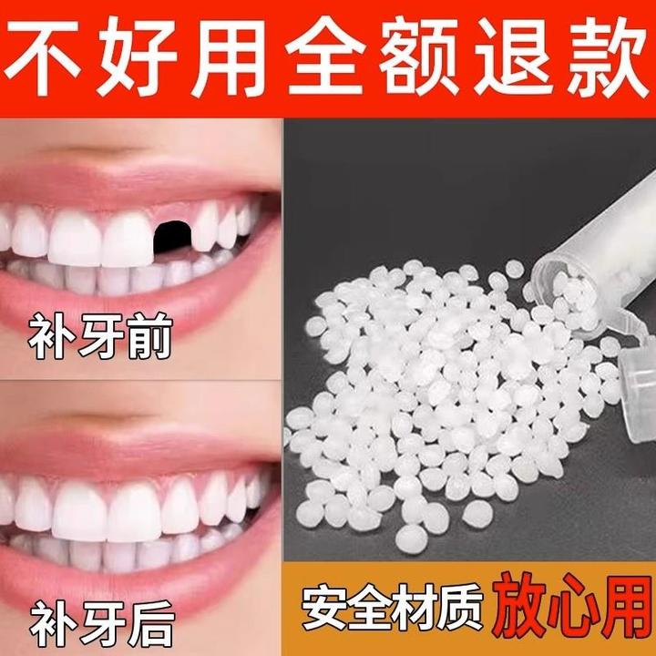 补牙神器树脂材料临时自己在家补牙高硬度洞膏补牙缝假牙牙套仿真