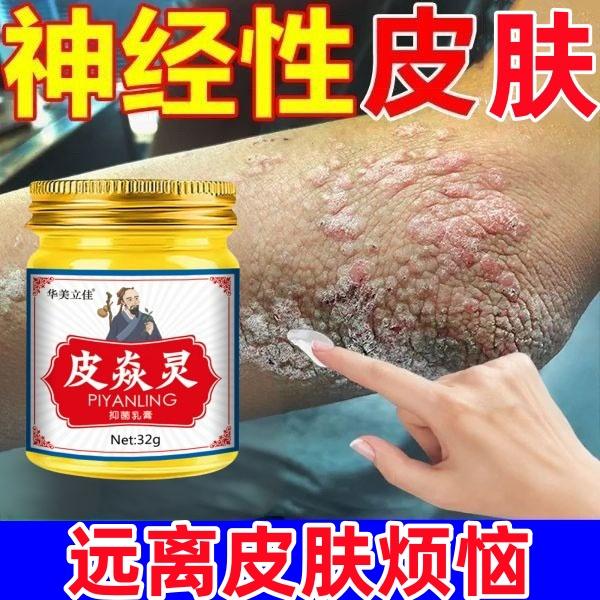 【神经性皮肤】日光性皮肤痒脂溢性皮肤痒全身可用清凉止痒外用乳膏