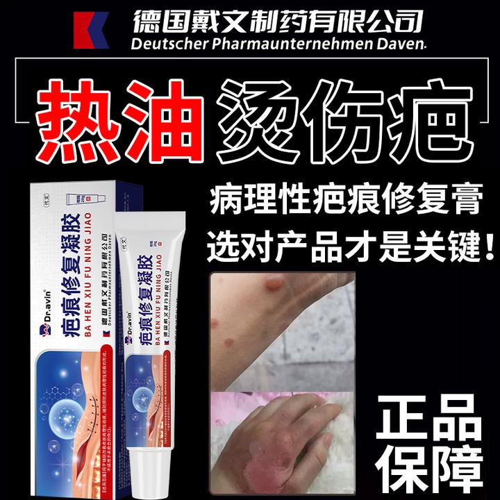 代文烫伤疤痕修复膏改善皮肤病理性疤痕预防皮肤病理性疤痕的形成疤痕修复凝胶