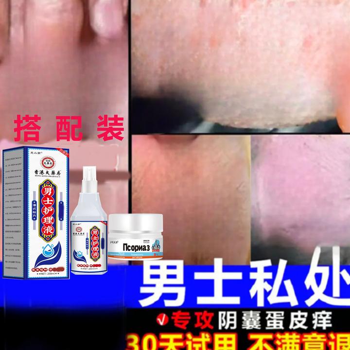 男人私处蛋蛋痒阴部~潮~湿`下体大腿内侧痒起乌龟皮疙瘩痒止痒膏