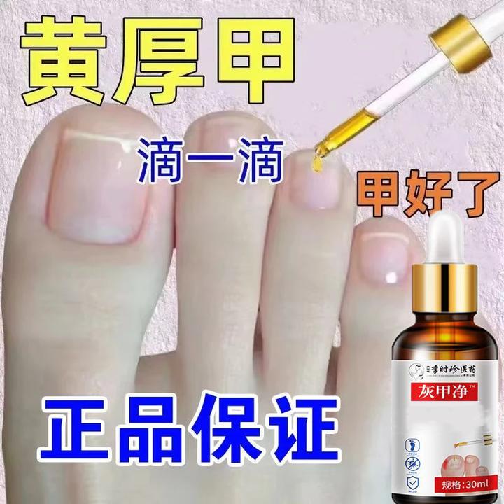 趾甲脚指甲专用亮甲抑菌液趾甲复抑菌液指甲专用抑菌液草本萃取