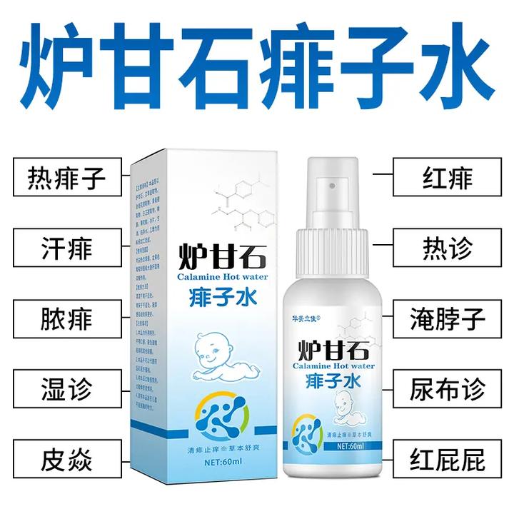 炉甘石痱子水成人婴幼儿童热痱子喷雾去痱子粉热疹止痒喷剂神器