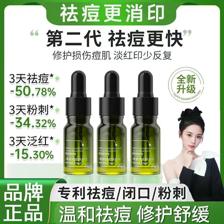 【官方正品】小绿瓶祛痘精华液祛闭口粉刺水杨酸控油淡痘印水丽可植