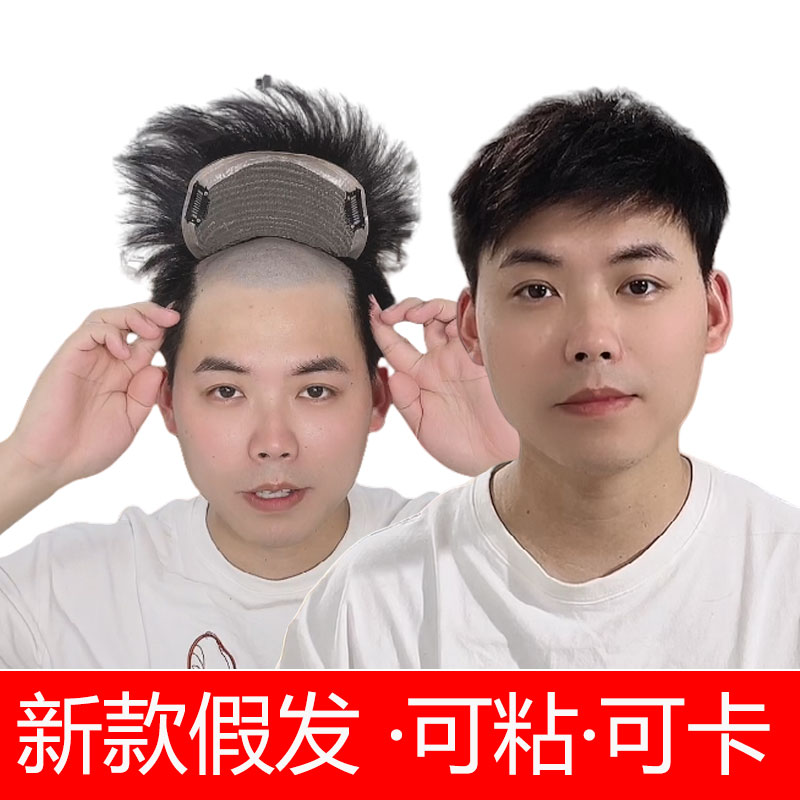 （机制款可粘胶可用卡）假发男士真发补发片男补发块机制可粘胶卡