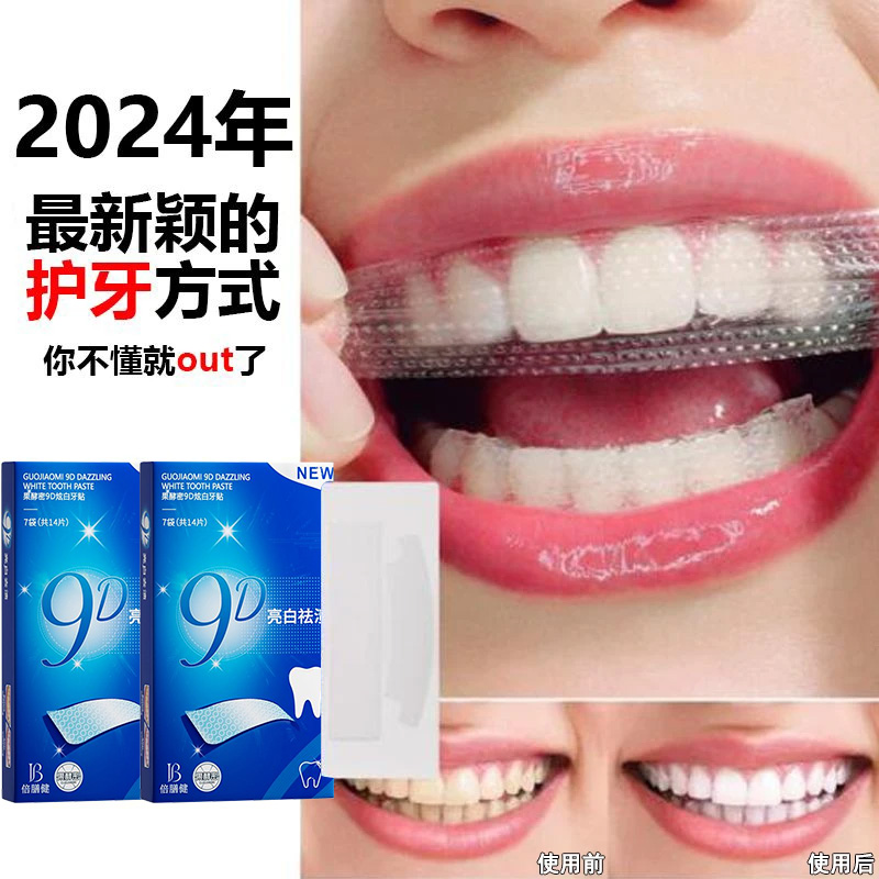 【官方正品✅】牙贴美白贴去黄洁白清洁牙渍亮白清新神器便携式美白