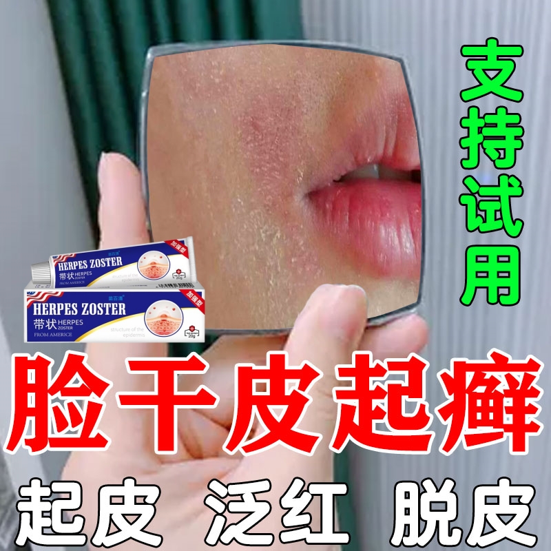 脸干燥起皮脸上皮肤干燥起皮鼻子两侧嘴角皮泛红干痒草本修护DZ膏