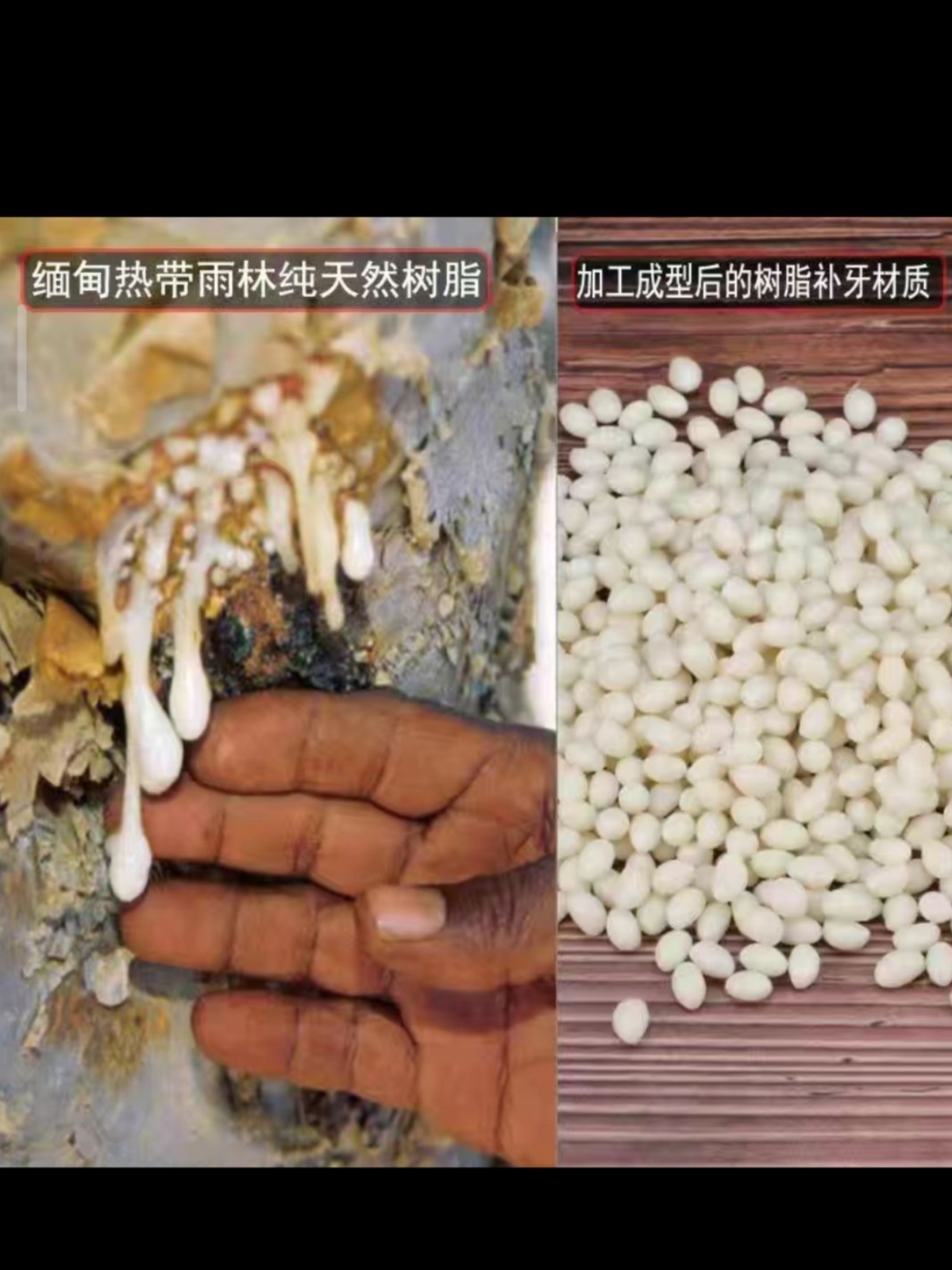 补牙洞填充剂神器自己动手牙齿补缺牙缝隙假牙补牙树脂胶修复材料