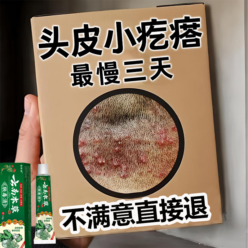 头上有疙瘩豆豆专用毛i囊堵i塞头皮草本萃取痒红i肿毛囊全身通用