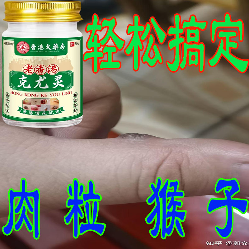 【小肉粒专用】老香港克尤灵去脖子肉粒手足腋下丝状扁平肉刺乳膏