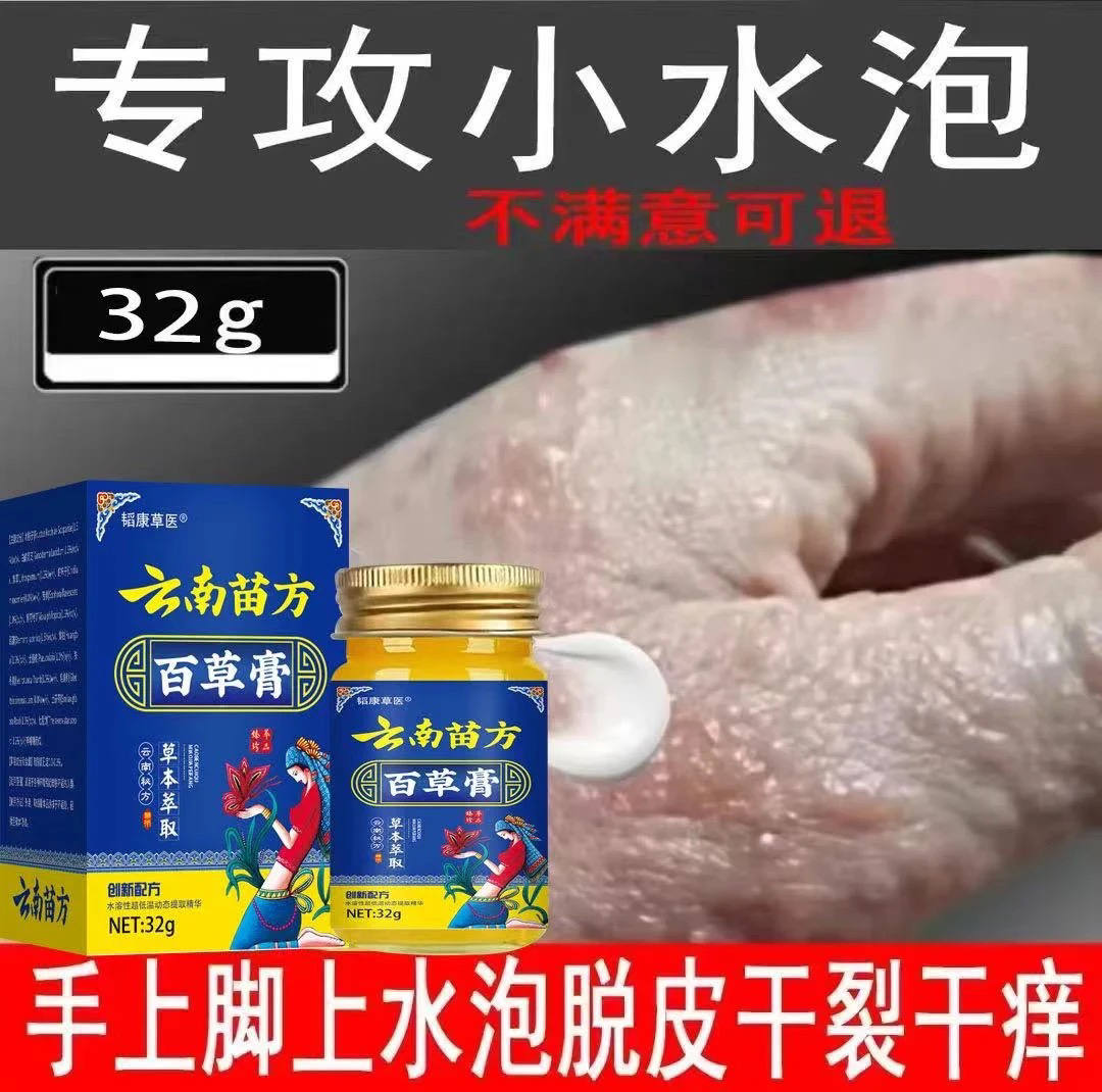 手起小水泡止痒膏王脱皮抑菌克星手指间痒干裂灵专用特喷剂效正品
