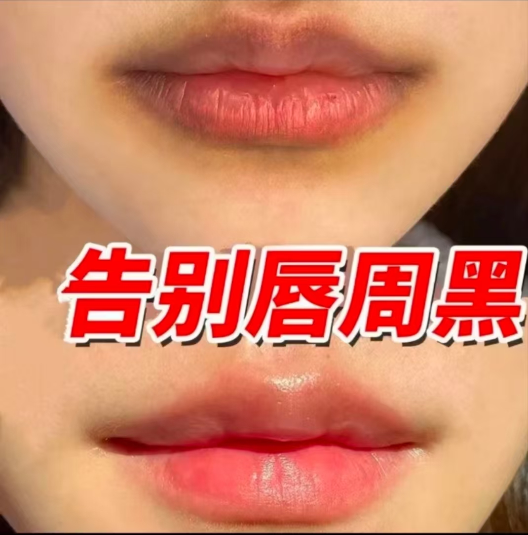 去唇周黑嘴角暗沉黑色素沉淀去除改善产品唇部提亮淡纹润唇草本膏