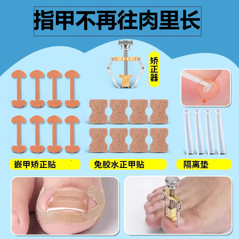 正甲贴甲沟炎矫正神器嵌甲脚趾指甲扎肉往肉里长专用纠正隔离垫片
