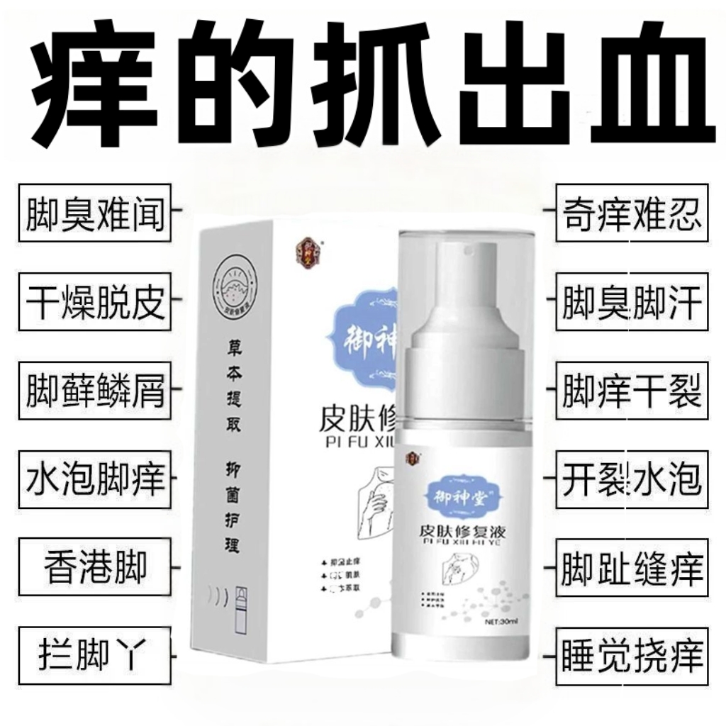 【止痒修复液】全身止痒外用手脚皮肤干痒抑菌喷雾草本精华萃取
