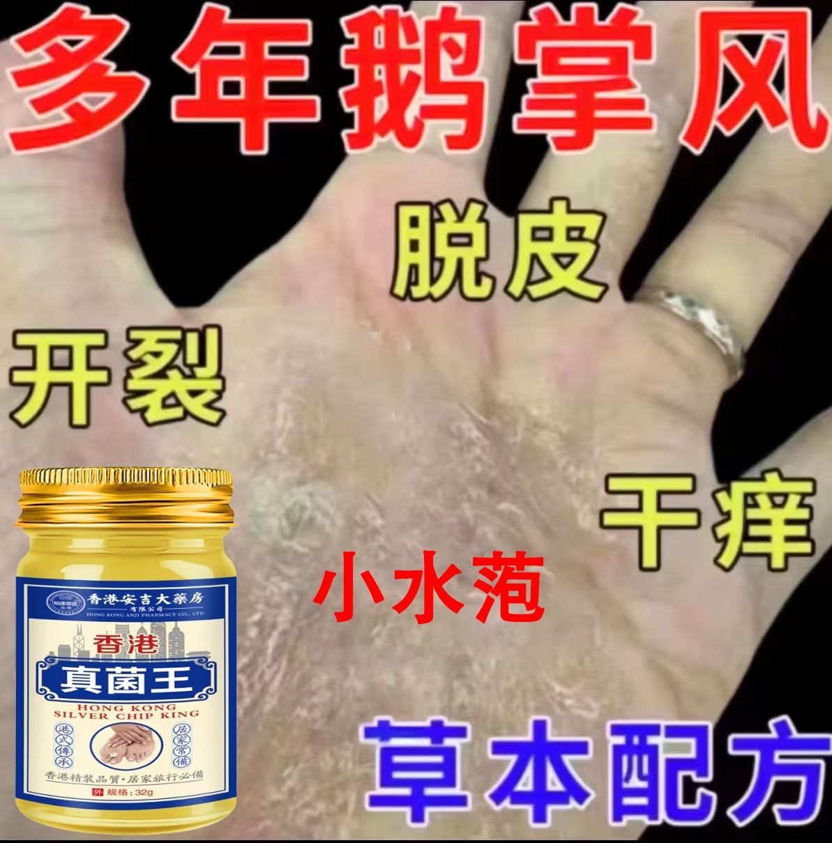 手指长小水萢手部痒手指开裂手指脱皮专用手上起汗泡抑菌专用软膏