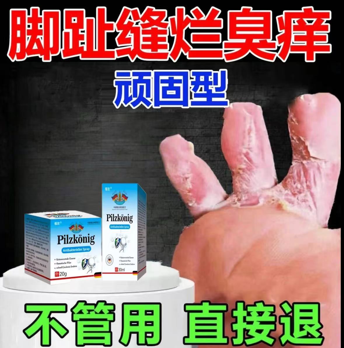 严重脚脱皮脚底板脱皮脚心痒脚痒起水泡起皮脚后跟干燥起皮裂口