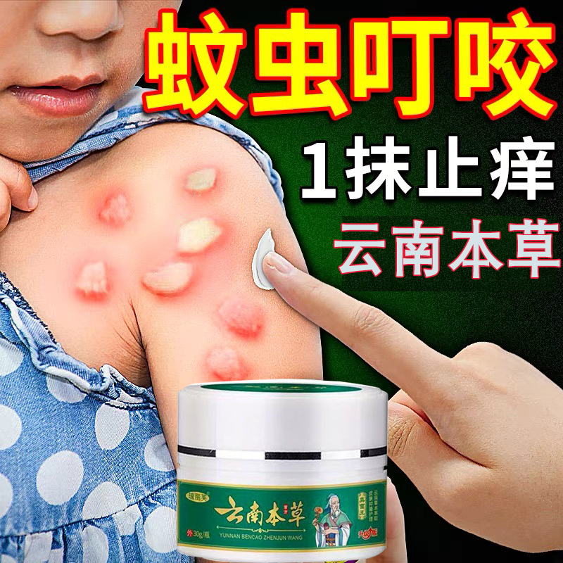 云南本草蚊虫叮咬止痒膏第一名儿童成人防蚊驱蚊消包止痒真菌王温