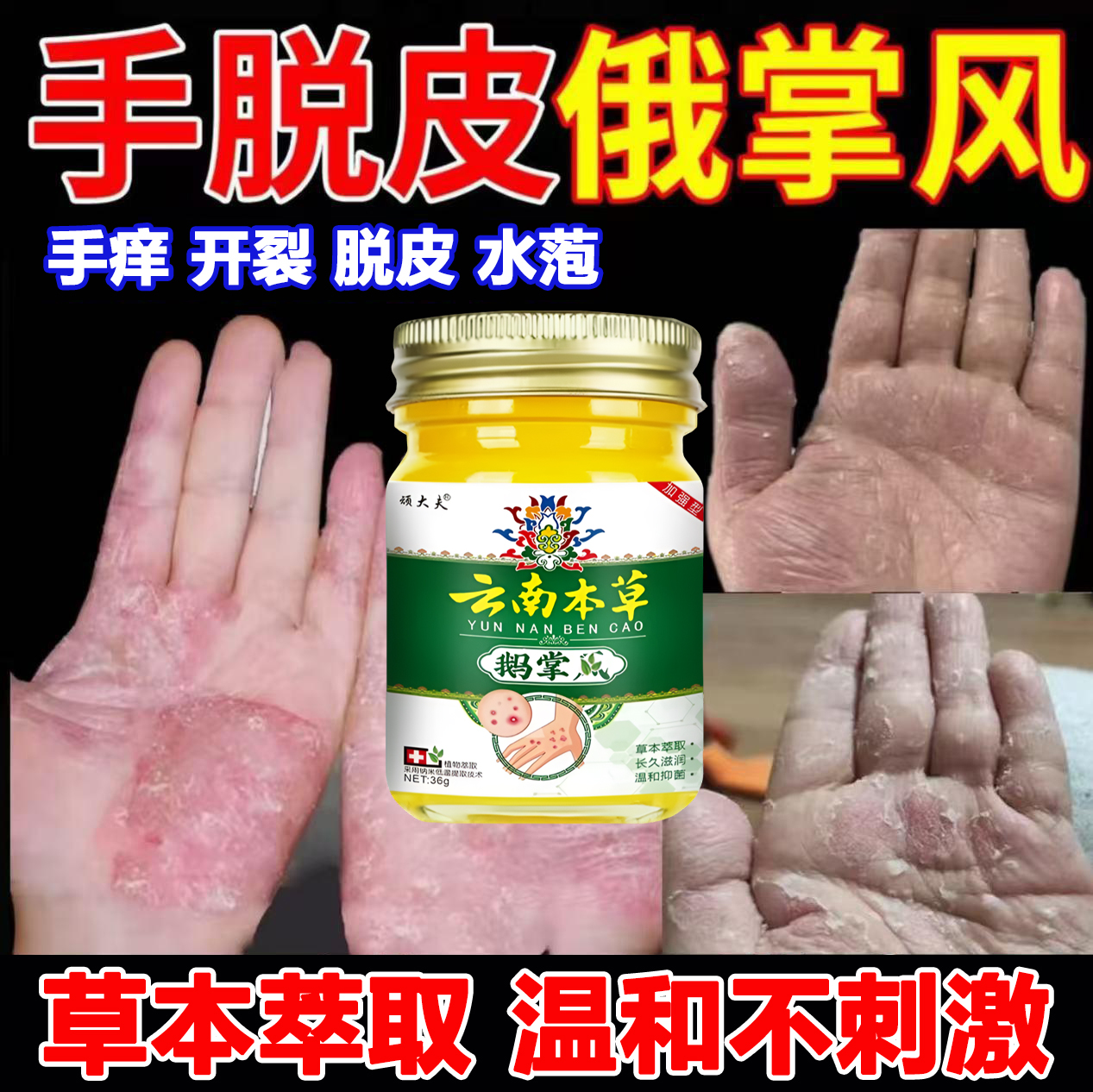 手足脱皮鹅掌风手部干裂脱皮手痒手裂手足起萢裂口起皮草本抑菌膏