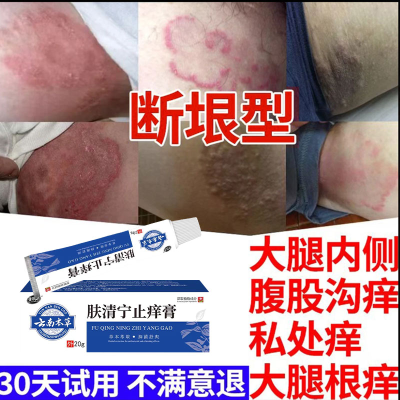 屁股【臀部】上长疙瘩痘痘久坐痒止痒膏刺挠红点抑菌乳膏