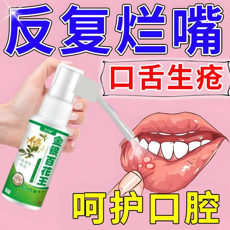 口腔溃疡口舌生疮嘴巴舌头烂上火三天两头烂嘴起泡舌尖疼草本喷剂