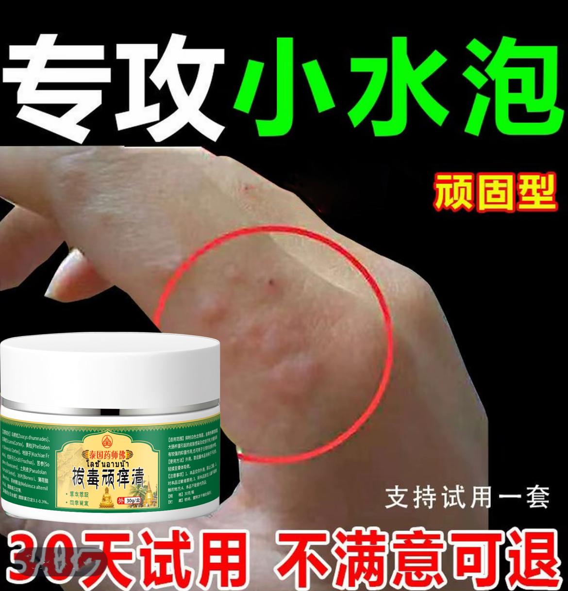 手指长小水泡手部痒手指开裂手指脱皮专用手足起汗泡抑菌止痒软膏