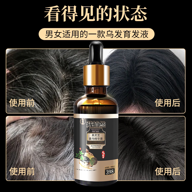 养发根黑头发专用