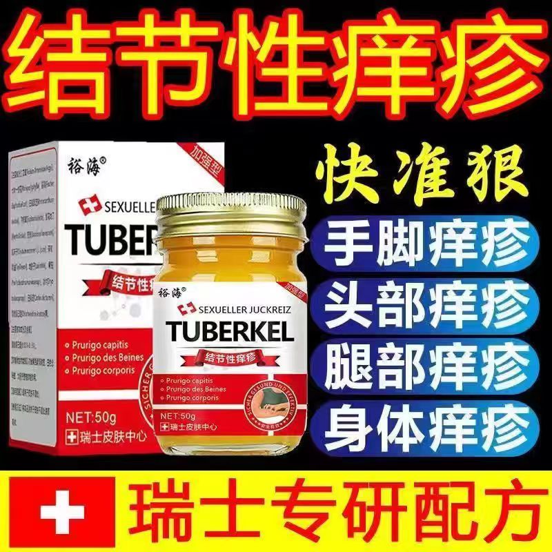 【瑞士配方】结节性痒疹全身长硬疙瘩结节硬块全身止痒身体护理膏