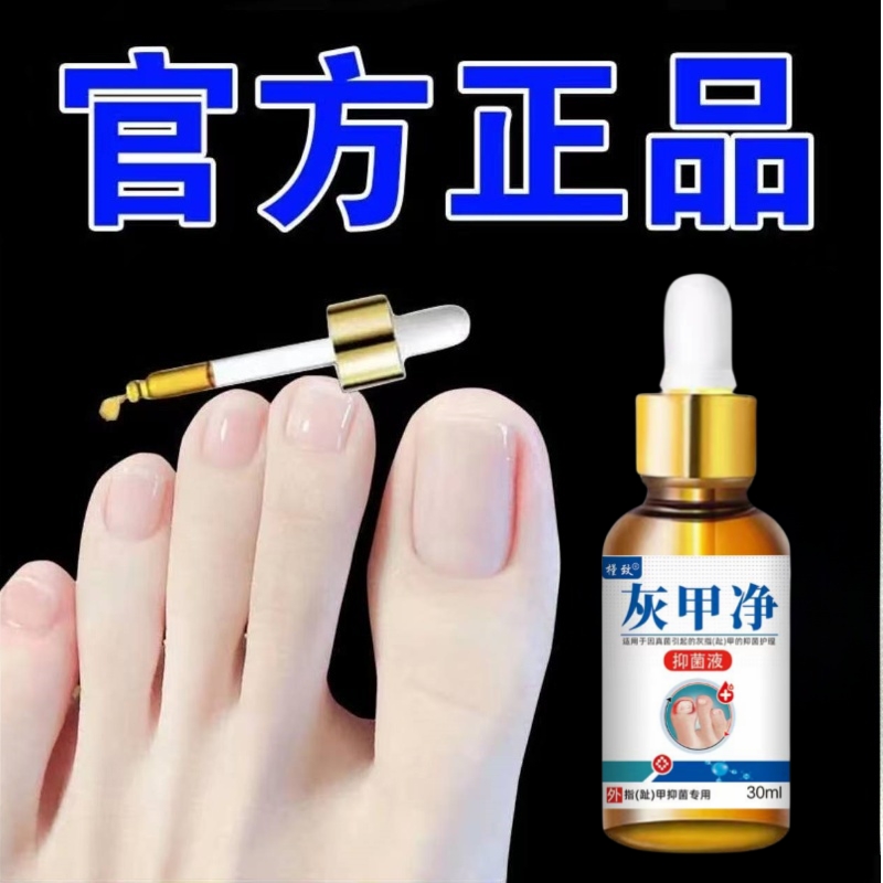 【顽固灰甲】灰甲液灰指甲趾甲增厚发黄甲变身沟焱灰指甲修复