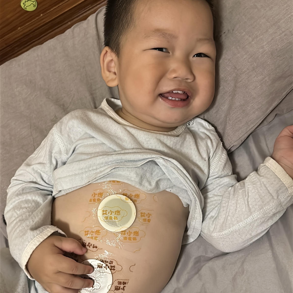 艾小燃肚肚贴1盒24贴（小孩用）