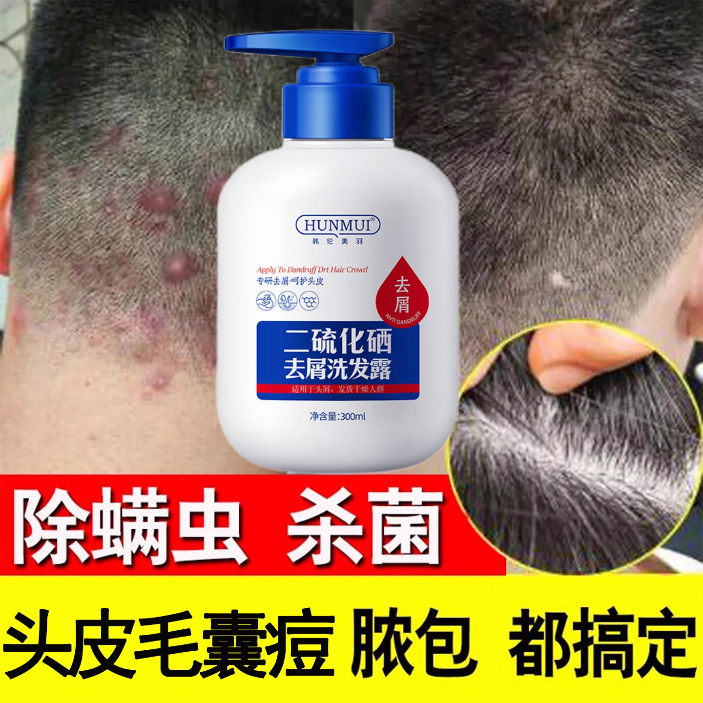 【去屑止痒】二硫化硒洗发水控油止痒除螨去头皮屑头皮疙瘩柔顺蓬松