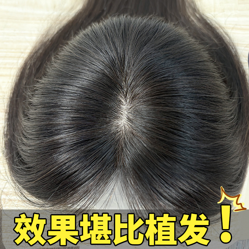 双递针假发女片头顶真发真人发丝遮白发高颅顶增发量轻薄无痕补发