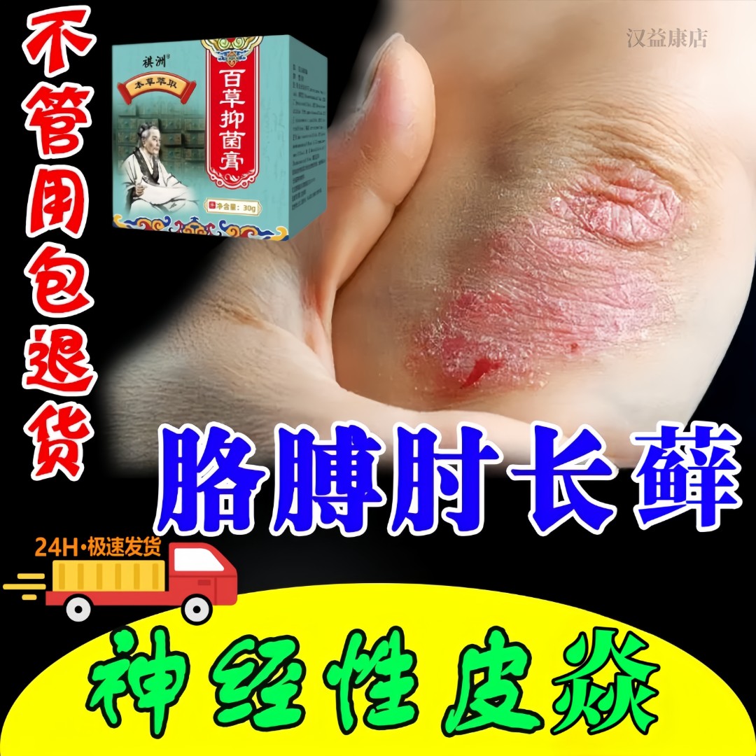 手肘藓手臂胳膊肘藓肚皮后背顽固性皮藓过敏止痒膏神经性皮焱凝胶