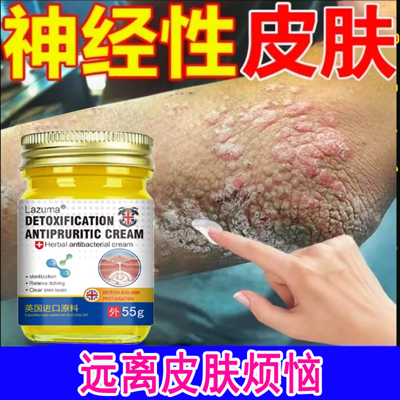 【神经性皮焱】无用包退脂溢性皮焱皮肤瘙痒全身可用草本止痒抑菌膏