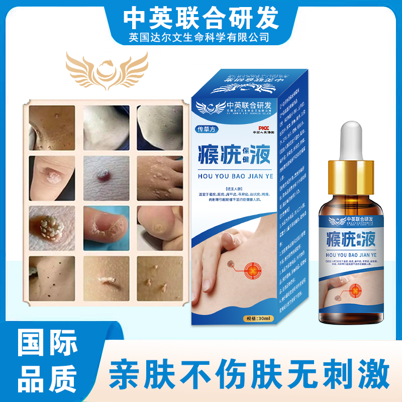 进口品质克优脖子小肉粒脸部腋下额头扁平丝状寻常快速瘊子脱落膏