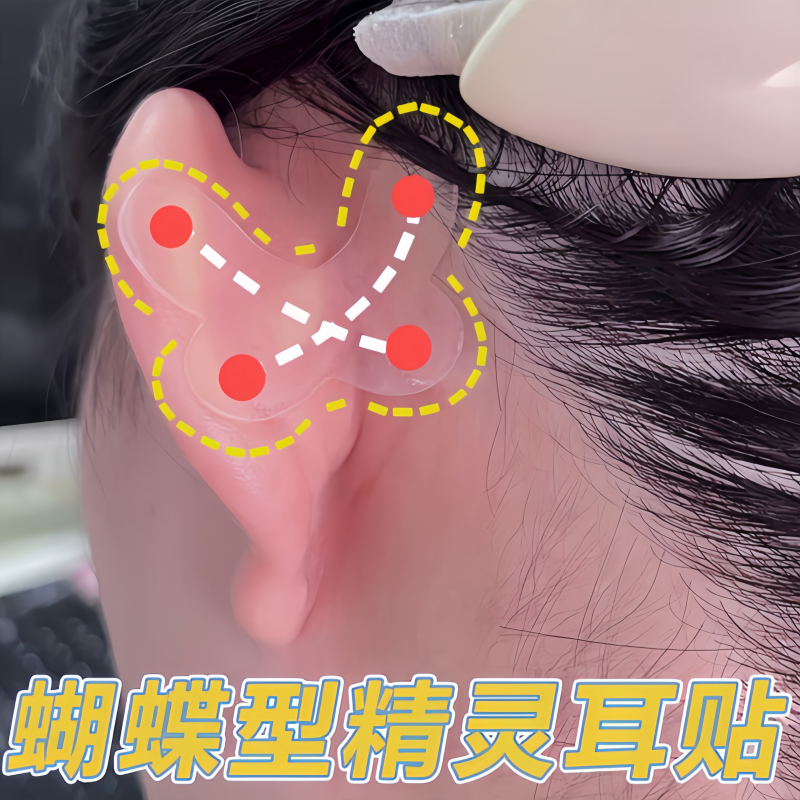 蝴蝶型精灵耳贴强支撑定型立耳好物大脸显脸小隐形撑耳朵男女贴面