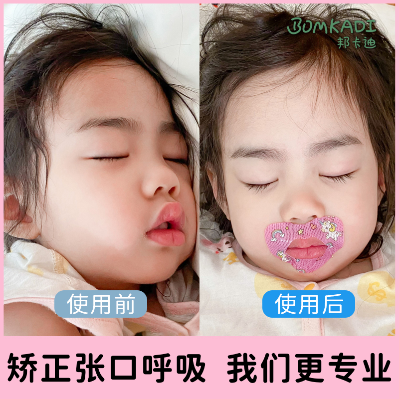 邦卡迪口呼吸矫正贴嘴巴封口贴腺样体纠正贴睡觉嘴巴闭合止鼾神器
