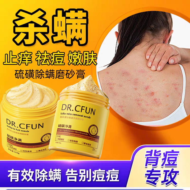 德国硫磺除螨磨砂膏身体除螨全身后背祛痘去角质鸡皮疙瘩黑色素