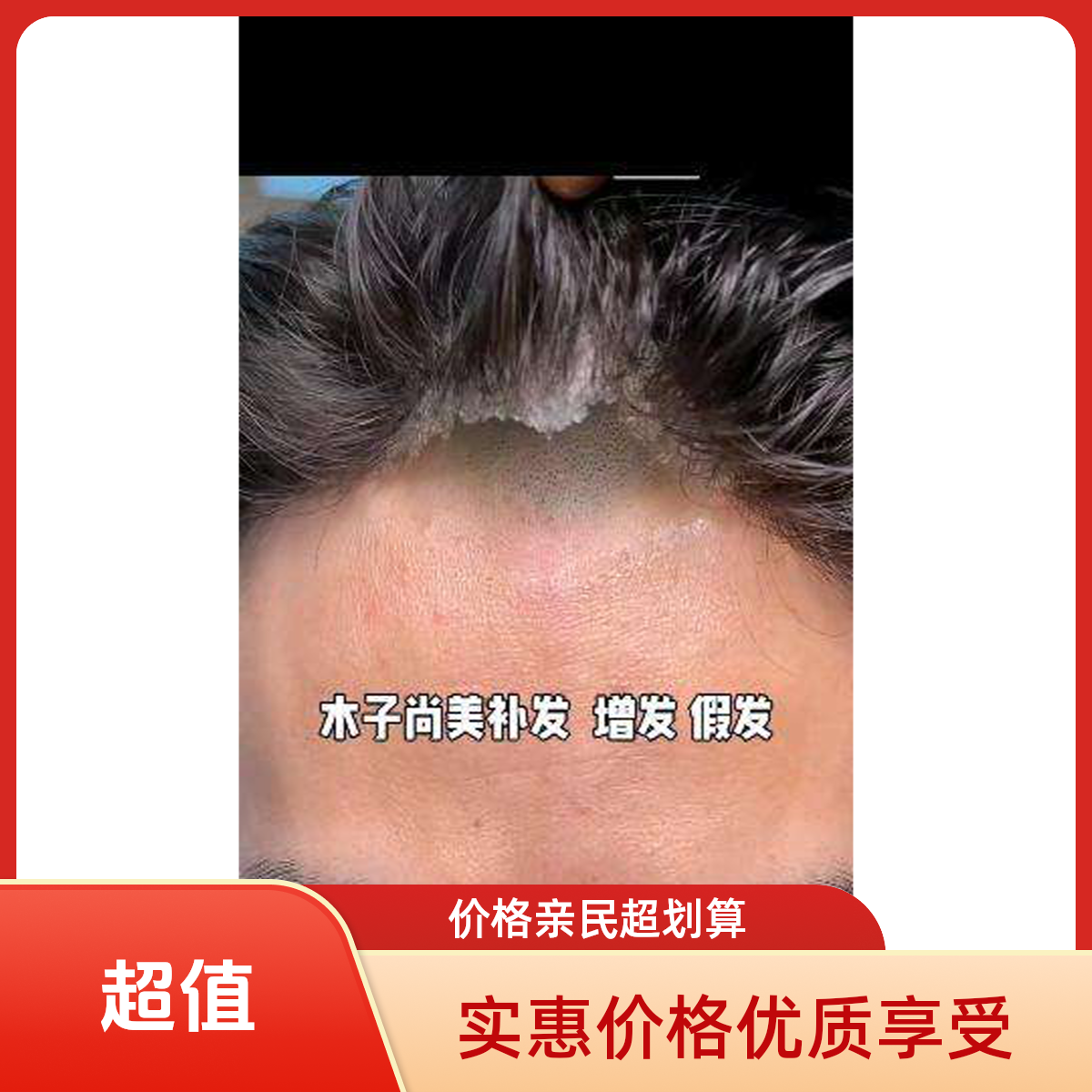 真发丝头顶补发片无痕女款  手沟左右12前后13