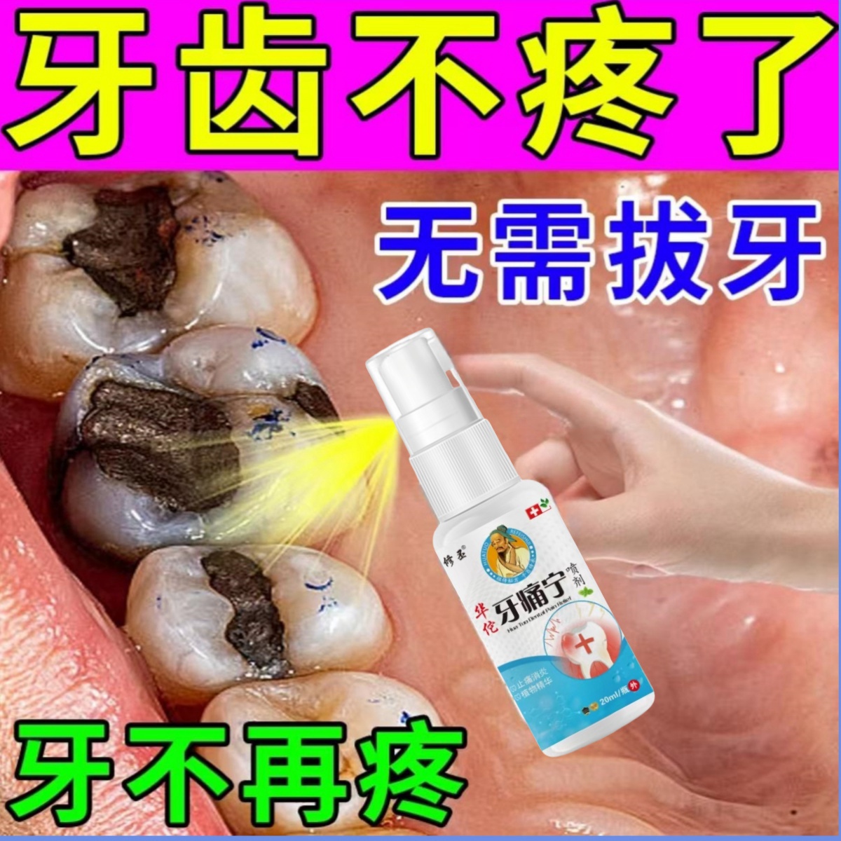 去牙疼牙痛立可停喷雾剂神器速效智齿发炎止疼上火牙龈肿痛蛀虫
